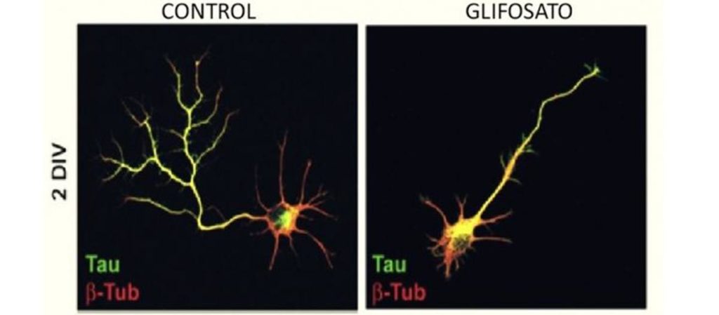 imagen de microscopia de las neuronas normales y las tratadas con glifosato